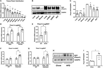 Mechanosensitive Ion Channel Piezo1 Regulates Diet-Induced Adipose Inflammation and Systemic Insulin Resistance